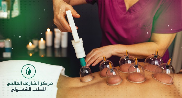 الحجامة في مركز الشارقة الطبي